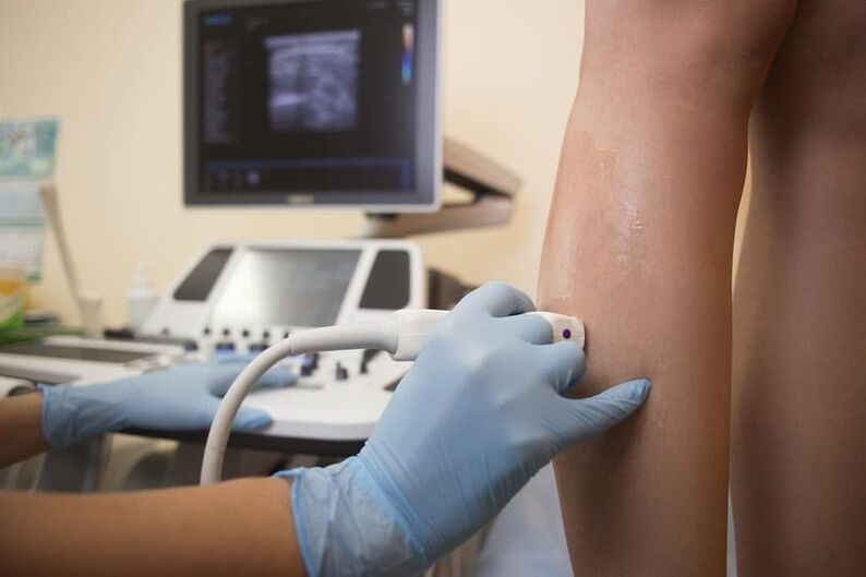 ultrasound diagnosis of varicose veins