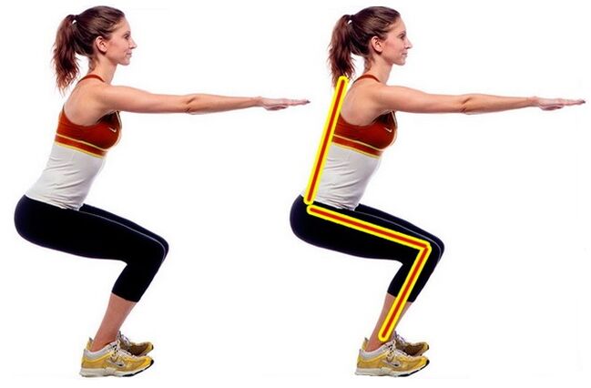 squat for varicose veins